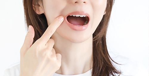口内炎ができやすい人
